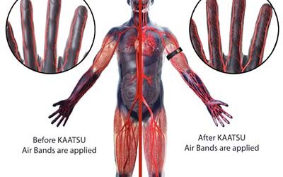 Is KAATSU the Same as Blood Flow Restriction (BFR)?