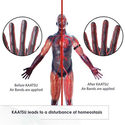 Is KAATSU the Same as Blood Flow Restriction (BFR)?