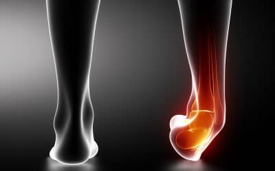 KAATSU For Sprains